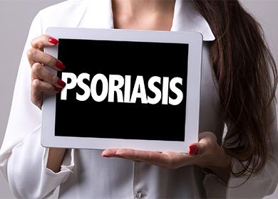 Inskripsiyon ng psoriasis